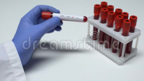 阴性CMV检测医生抽血实验室研究健康检查视频的预览图