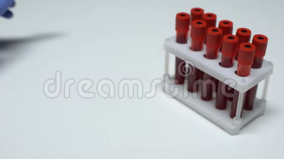 铅试验阳性医生提供血样实验室研究健康检查视频的预览图