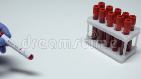 麻疹试验阴性医生提供血样实验室研究健康检查视频的预览图
