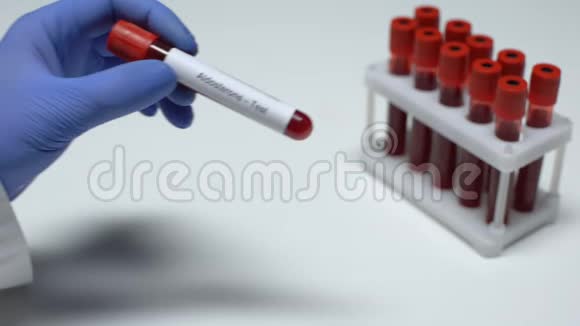 醛固酮医生在试管中显示血样实验室研究健康检查视频的预览图