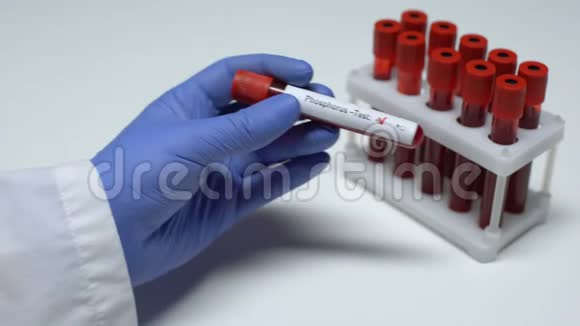 阴性磷试验医生在试管中显示血样实验室研究视频的预览图