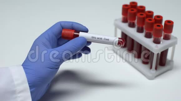 尿酸医生在试管中显示血样实验室研究健康检查视频的预览图