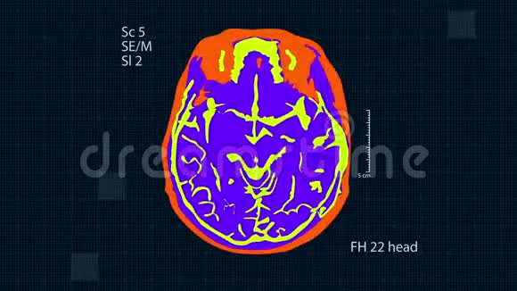 脑MRT扫描全高清医学背景无缝循环视频的预览图
