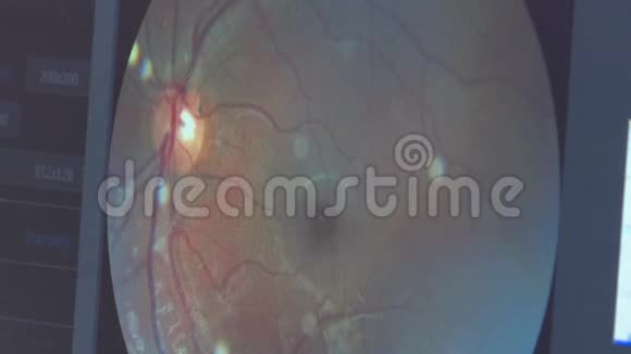 电脑眼科检查检查眼睛健康和视力对视力的诊断视频的预览图
