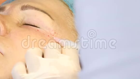 中疗注射做面部手术的老妇人专业美容师手里拿着注射器视频的预览图