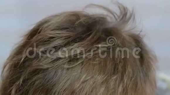 梳理达森瓦尔梳理毛发微电流的程序皮肤医疗程序从后面看女人的头视频的预览图