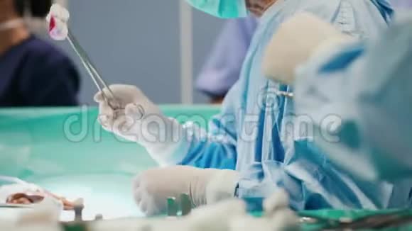 忙碌的外科医生在手术中互相递剪刀视频的预览图