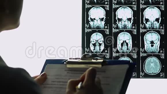 女性放射科医生填写医学报告描述大脑mri结论视频的预览图