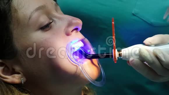 拜访牙医安装支架系统口腔医生用牙科聚合紫外线灯照在视频的预览图