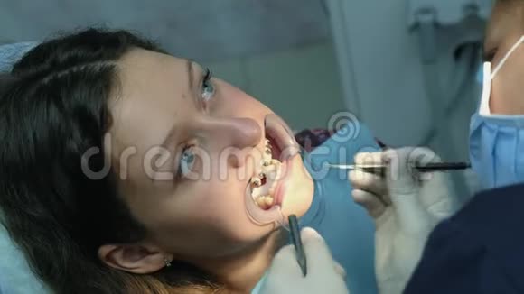 拜访牙医安装支架系统和矫正错牙合俯视图矫正师视频的预览图