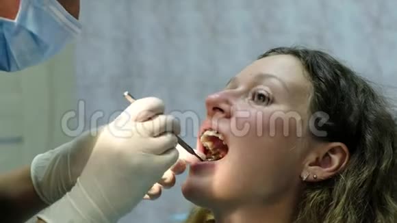 拜访牙医安装支架系统正畸师完成安装病人已经视频的预览图
