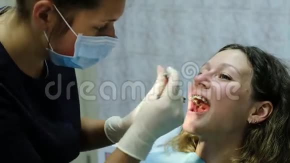 拜访牙医安装支架系统正畸师建立金属正畸弓和咬合视频的预览图