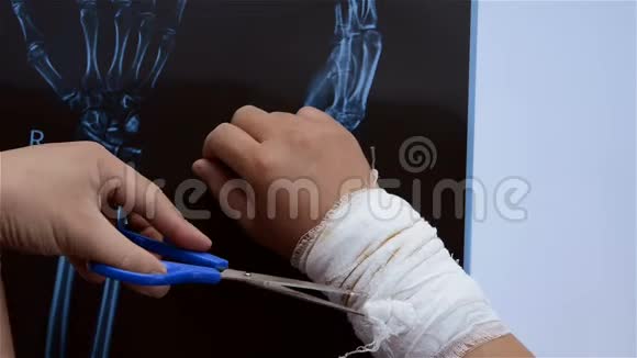 新鲜的去皮虾旋转用X光胶片将包裹绷带紧贴在手上使其受伤视频的预览图