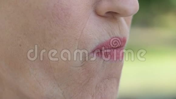退休女士口腔不适牙龈发炎牙周炎视频的预览图