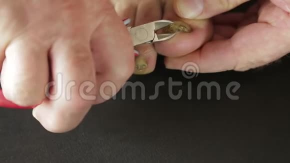 一个男人用真菌工具割指甲视频的预览图