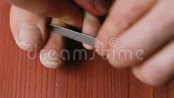 男人正在用指甲档案特写剥掉腿上的指甲一个男人在家里做足疗在地板上在顶部视频的预览图