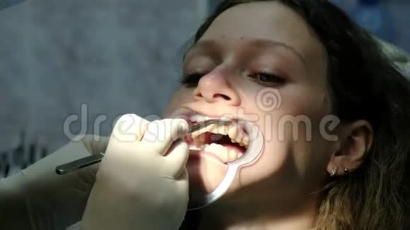 牙医在安装支架系统特写前将棉毛放入病人口腔并擦干牙齿视频的预览图