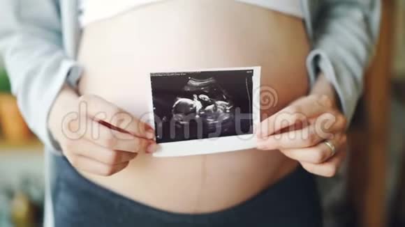 大腹便便的特写镜头和妇女双手握着健康未出生婴儿的超声波图像怀孕妇女视频的预览图