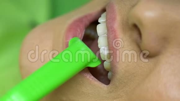 医生用水工具清洗病人牙齿上的密封残留物治疗视频的预览图