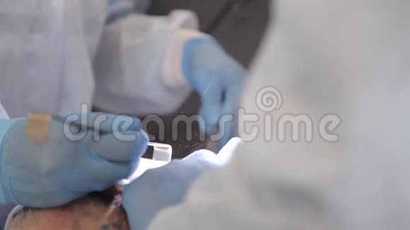 牙医做手术视频的预览图