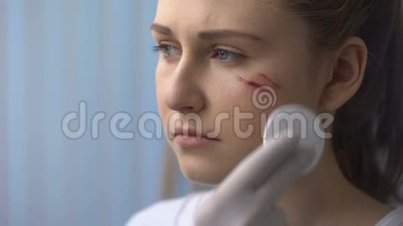 车祸后女性患者面部伤口的治疗医生视频的预览图