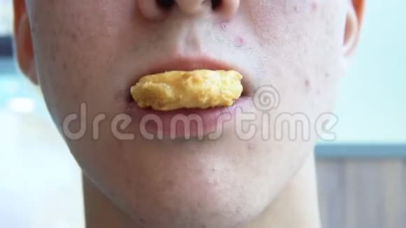 一个脸上长着粉刺的年轻人吃鸡块视频的预览图