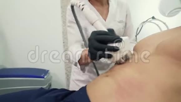 医生的特写镜头戴手套的美容师在病人的腹部引导射频提升装置视频的预览图
