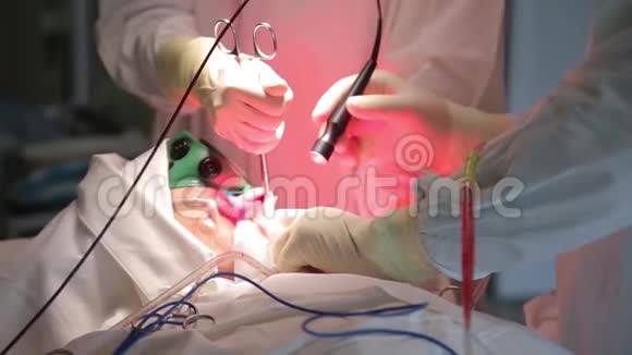 特写镜头一组外科医生进行手术切除肿瘤光动力疗法视频的预览图
