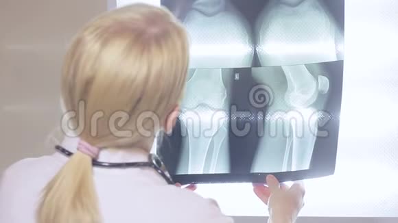 女医生检查了膝盖的X光图像视频的预览图