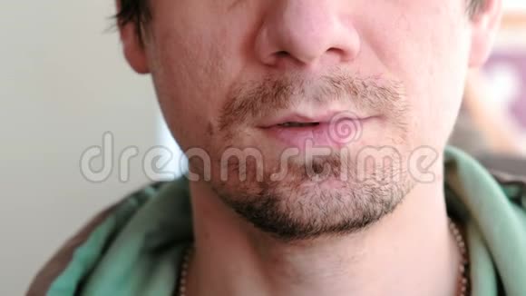 人摸唇疮疱疹嘴唇治疗男人嘴唇疱疹的特写前景视频的预览图
