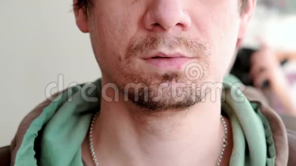 疱疹嘴唇治疗男人嘴唇疱疹的特写男人把奶油放在嘴唇上前景视频的预览图