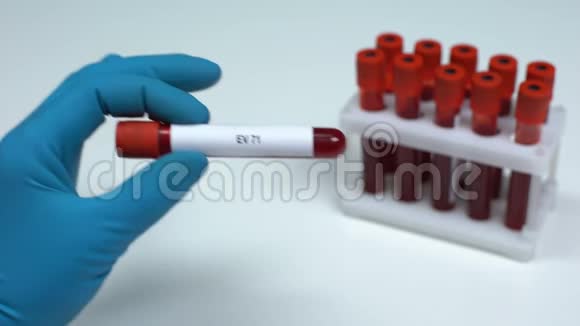 EV71医生在试管中显示血样实验室研究健康检查视频的预览图