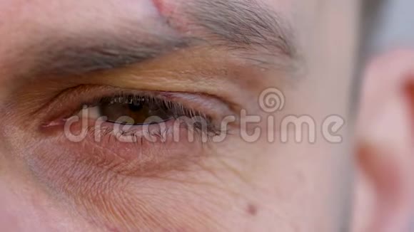 俊男眼的特写正看着镜头眉毛被剪掉眼下的瘀伤视频的预览图