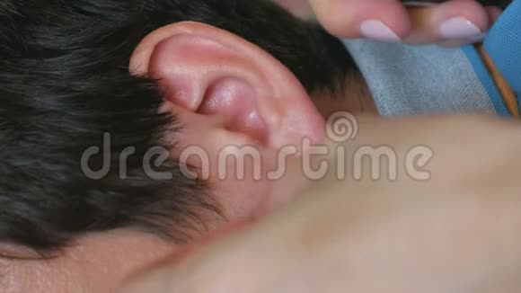 女人在男人耳朵打嗝耳病的治疗手和耳朵特写视频的预览图