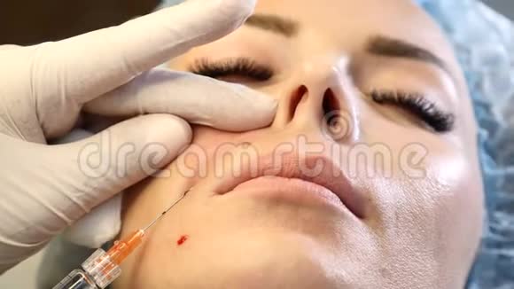 将美容师的手贴在女性客户的脸上医生拿着注射器和套管针面部提升概念4k视频的预览图
