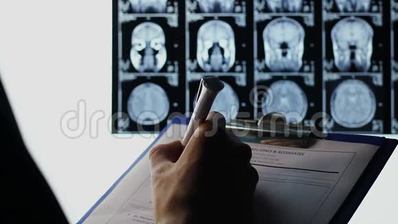 医生记下处方观察病人头部MRI视频的预览图