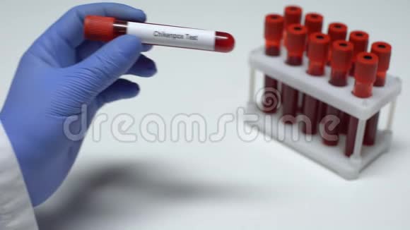 水痘医生在试管中显示血样实验室研究健康检查视频的预览图