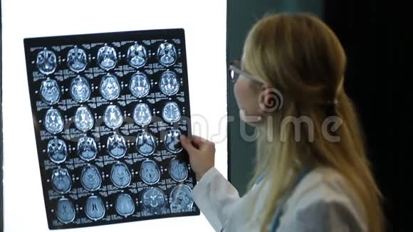 医生仔细检查病人的核磁共振扫描视频的预览图