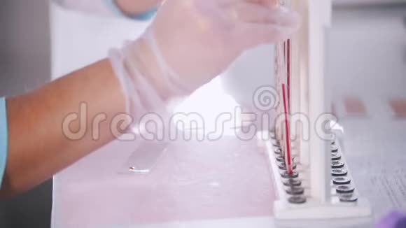 医疗诊所验血一名负责血液样本的护士侧角视频的预览图