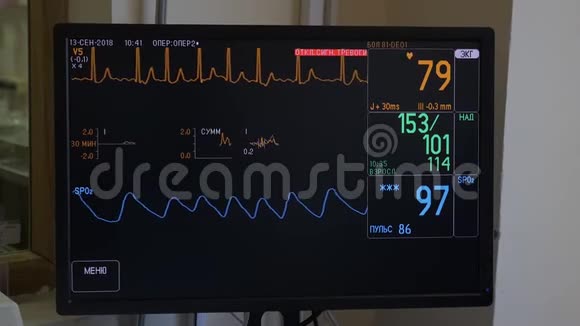 心电监护仪显示病人在手术室情况视频的预览图