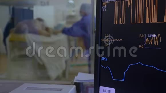 显示病人在心脏手术时状况的监视器视频的预览图
