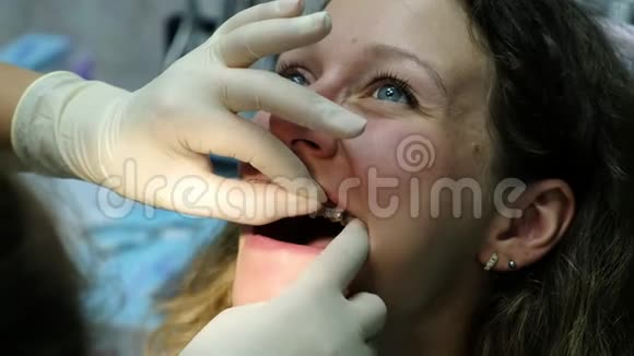 去看牙医正畸医生在铁支撑特写上设置弧线视频的预览图