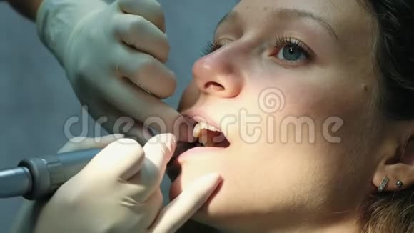 牙医在安装支架系统特写之前研磨和清洁牙齿去看牙医视频的预览图
