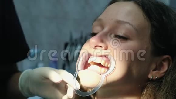 牙医在安装支架系统之前在固定器中润滑牙齿拜访口腔医生视频的预览图