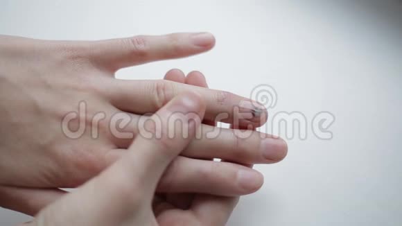 病钉上的瘀伤不健康受损手指指甲女孩检查白色指甲异常视频的预览图