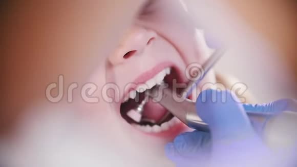 牙医女牙医慢动作抛光小宝宝牙齿视频的预览图