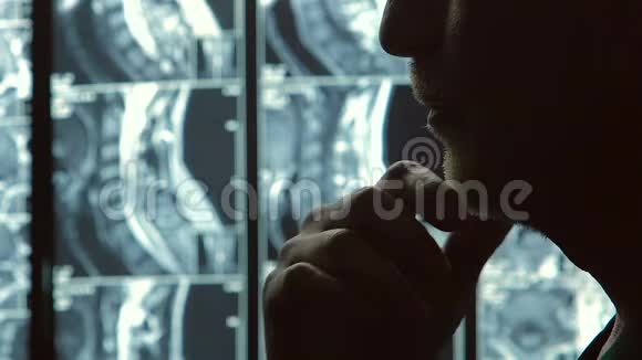 脊柱核磁共振扫描医疗保健特写视频的预览图
