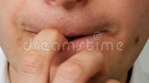 紧张的人用牙齿咬断手指上的指甲合上视频的预览图