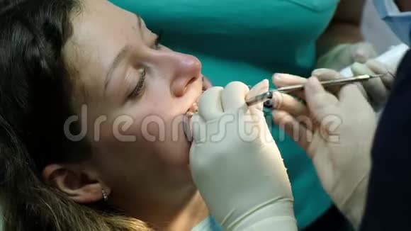 去看牙医正畸医生为一名妇女安装铁支架并在口腔特写中使用工具视频的预览图