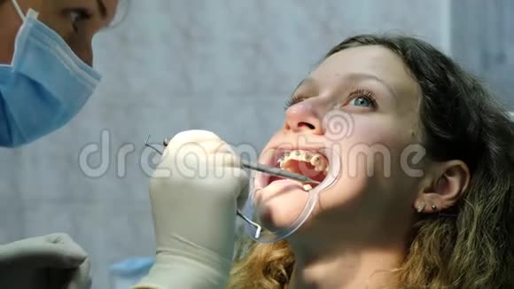 金属支架系统安装固定去看牙医矫正牙颌畸形视频的预览图